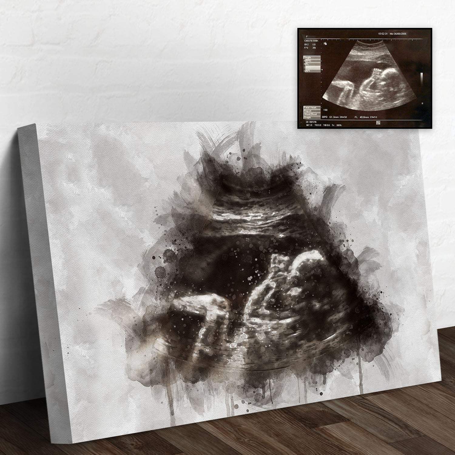 Custom Baby Ultrasound Watercolor Portrait - Tailored Canvases - Flyclothing LLC
