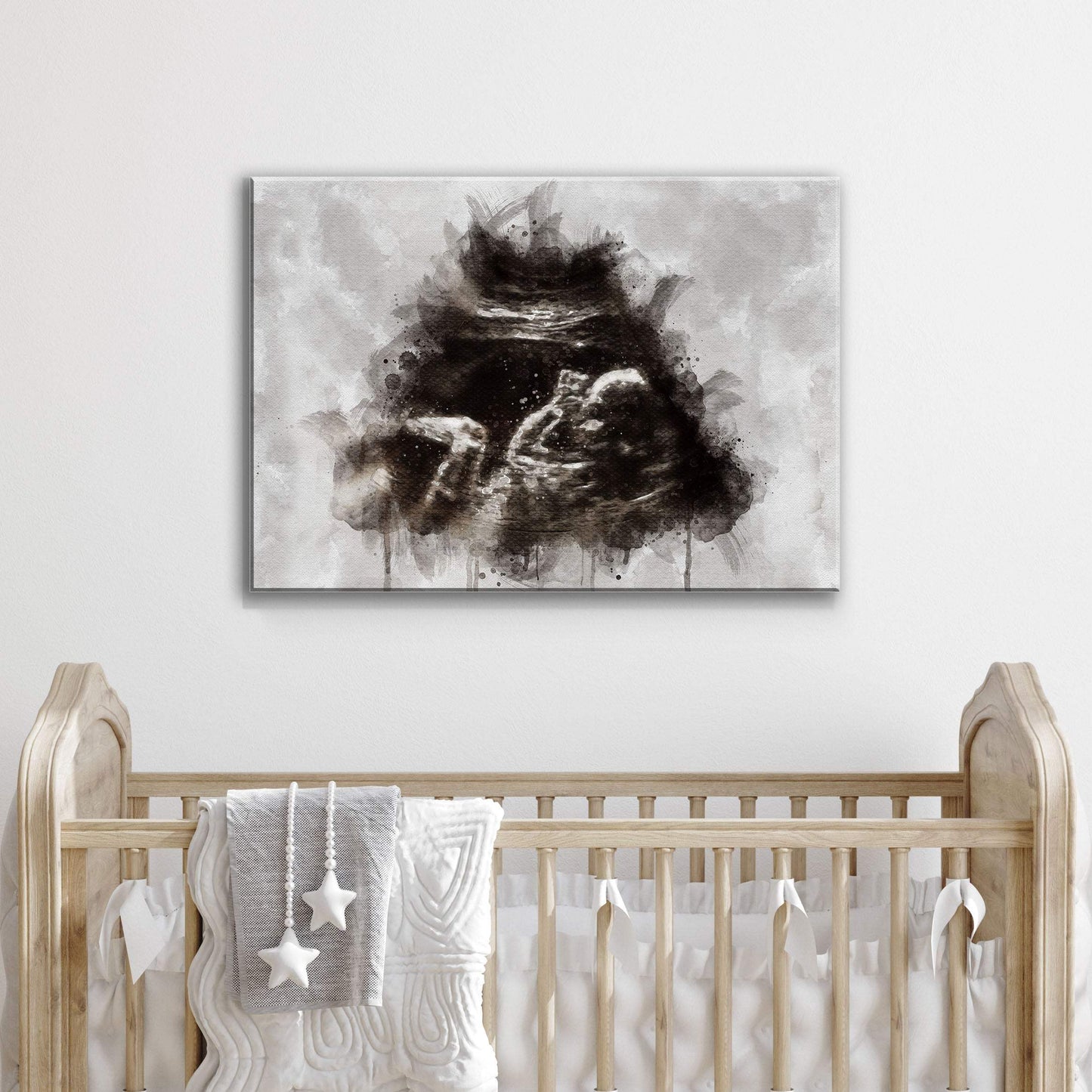 Custom Baby Ultrasound Watercolor Portrait - Tailored Canvases - Flyclothing LLC