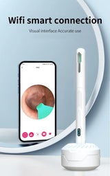 Ear Cleaner with Camera Set HD Ear Sticks Otoscope USB C Charging Endoscope Wax Removal Tool Earpick Ear Cleaning Set NK3 Pro - ZeeBelle.com - Flyclothing LLC