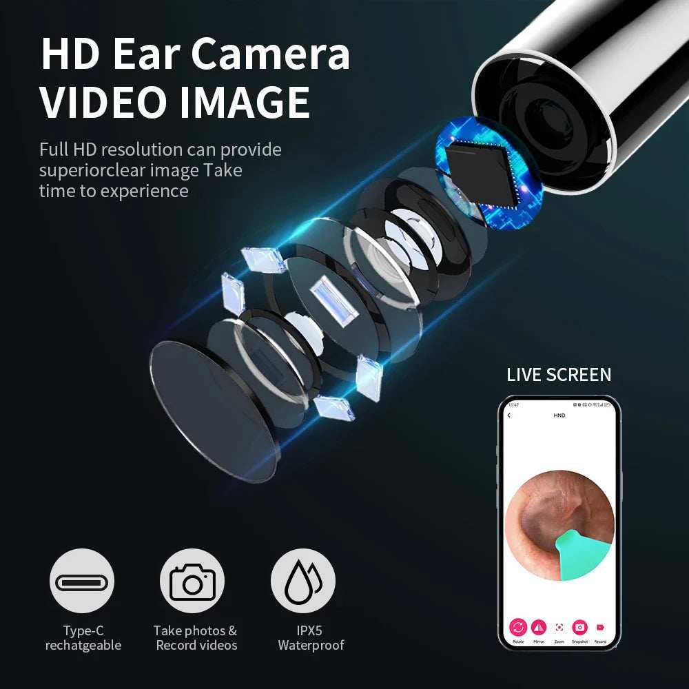 Ear Cleaner with Camera Set HD Ear Sticks Otoscope USB C Charging Endoscope Wax Removal Tool Earpick Ear Cleaning Set NK3 Pro - ZeeBelle.com - Flyclothing LLC